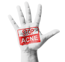 L’acné est un problème souvent rencontré chez les adolescent(e)s
